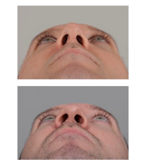 Re-do correctie: de neuspunt heeft meer projectie gekregen (waardoor ook de neusgaten zijn versmald).